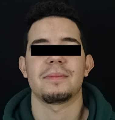 Ear Surgery Jacksonville